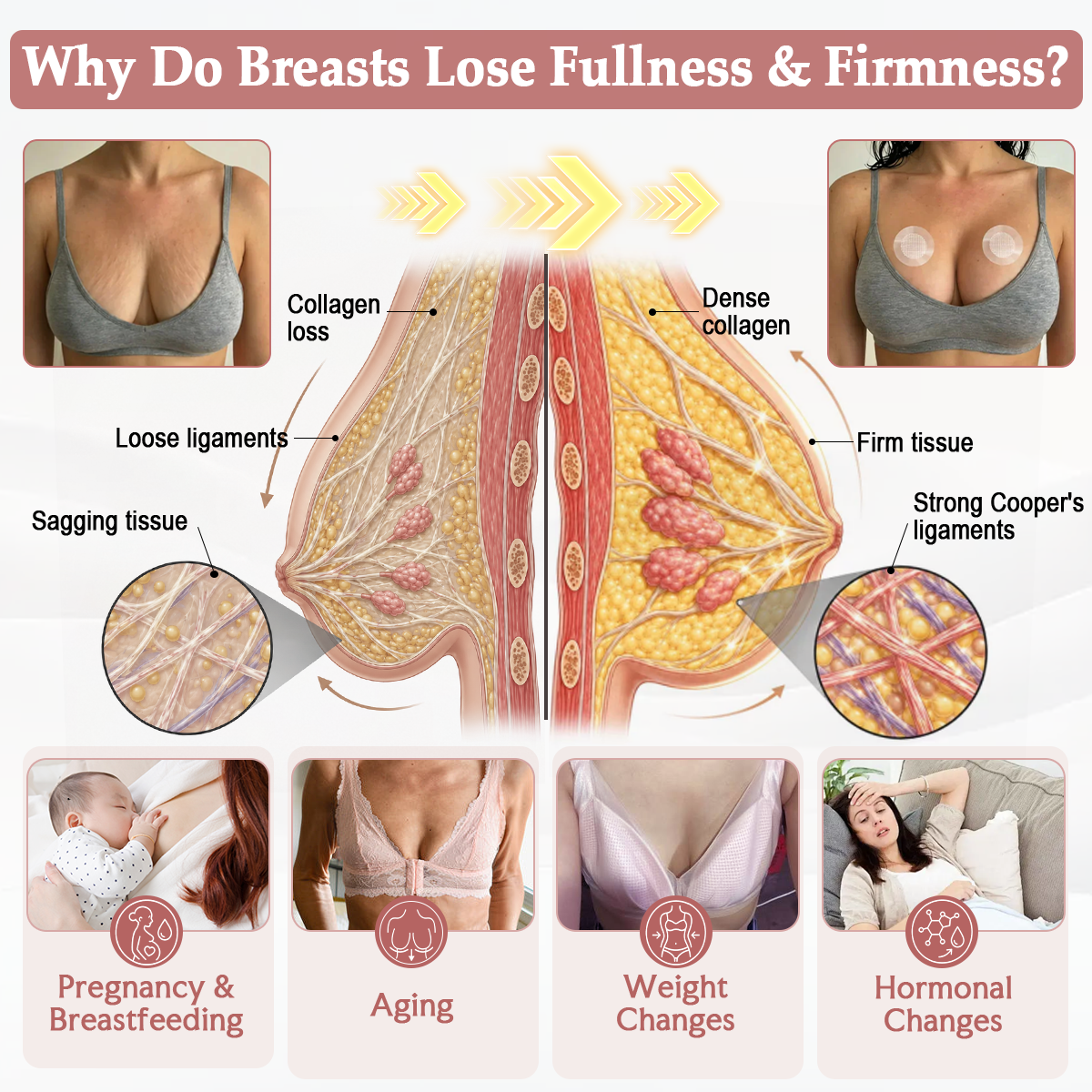 HISKIN® BREAST ENHANCEMENT  LIFT & FIRM MICRONEEDLE PATCHES