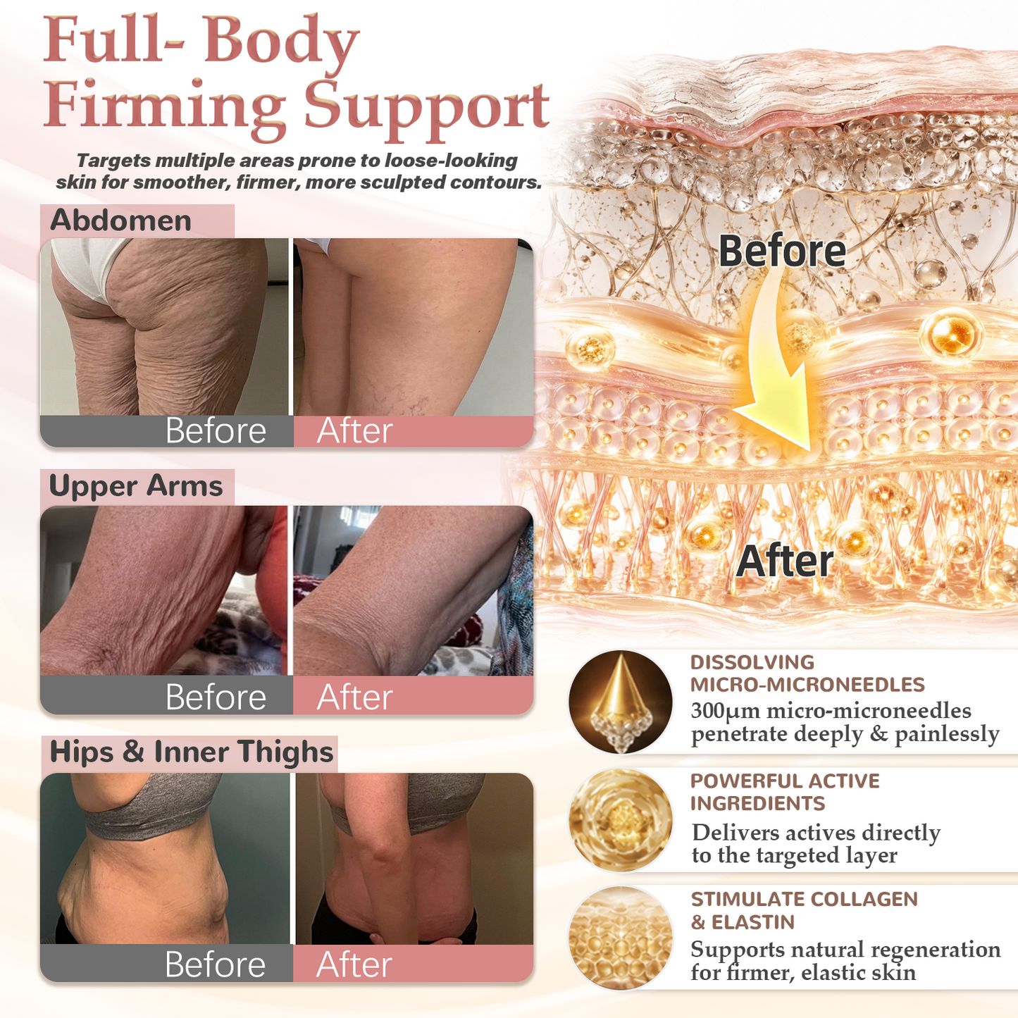 HISKIN® BREAST ENHANCEMENT  LIFT & FIRM MICRONEEDLE PATCHES